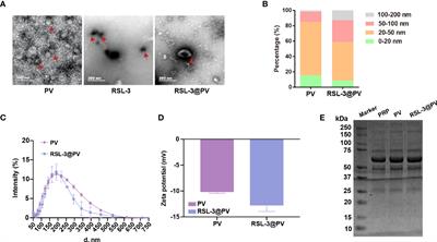 Platelet-Vesicles-Encapsulated RSL-3 Enable Anti-Angiogenesis and Induce Ferroptosis to Inhibit Pancreatic Cancer Progress